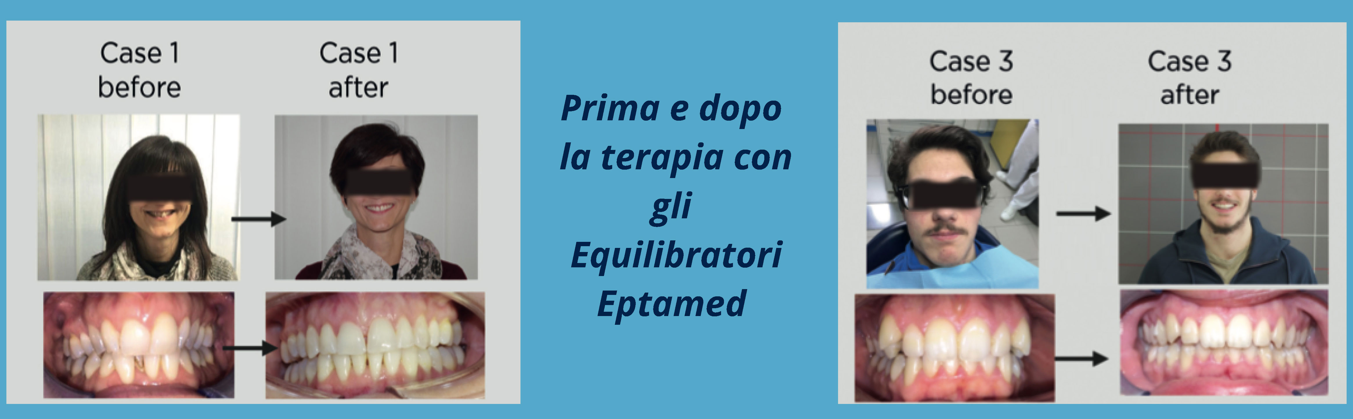 prima e dopo la terapia con gli Equilibratori Eptamed